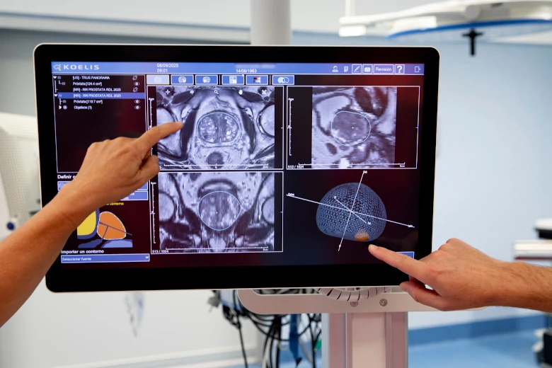 Cáncer de próstata